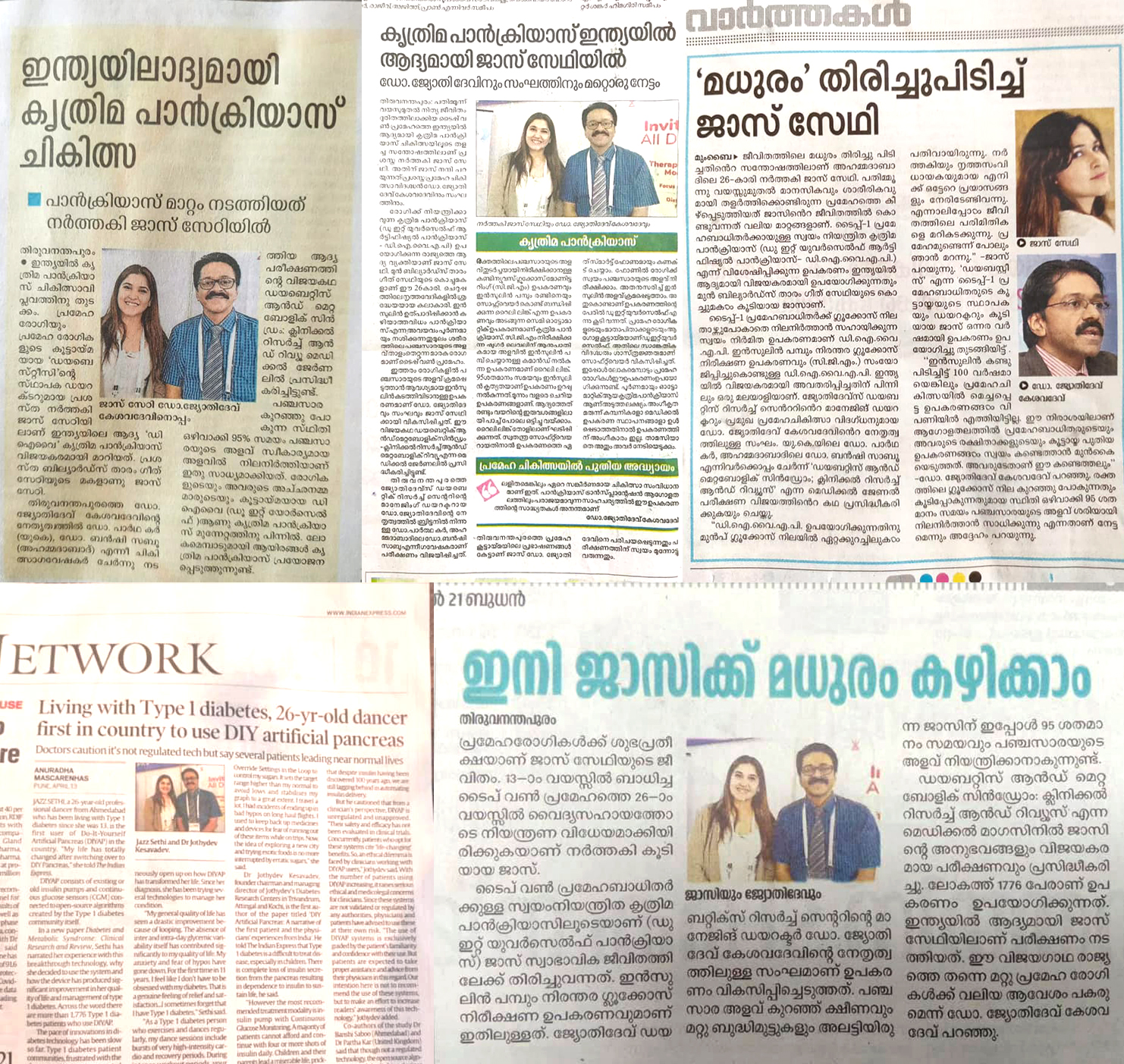 Article on DIY Artificial Pancreas in newspapers, online news and news channels