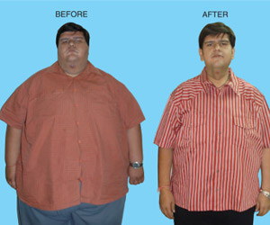 http://s5.miid.me/bariatric_surgery.jpg