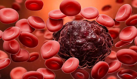 Diabetes Medication Linked to Reduced Blood Cancer Risk