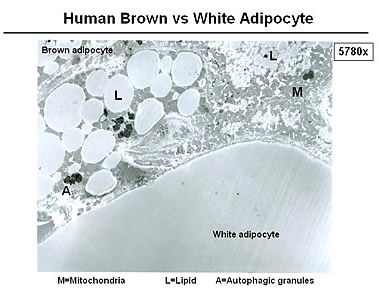 Description: http://img.timeinc.net/time/daily/2009/0904/brown_fat_0408.jpg