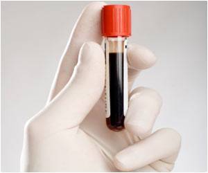 http://www.medindia.net/health-images/blood-test2.jpg