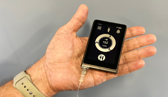 Bionic pancreas in type 1 diabetes 