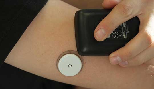 Flash Glucose Monitoring reduces adverse diabetes events, emphasizes RELIEF Study00