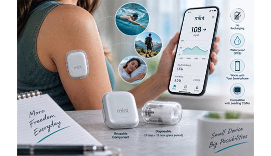 Mint™: A New Tubeless Insulin Pump Moves Toward More Personalized Insulin Delivery